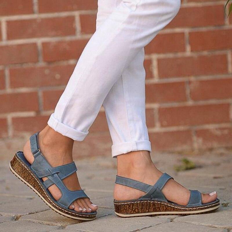 Stylish Orthopedic Summer Sandals – Comfortable and Supportive for Women